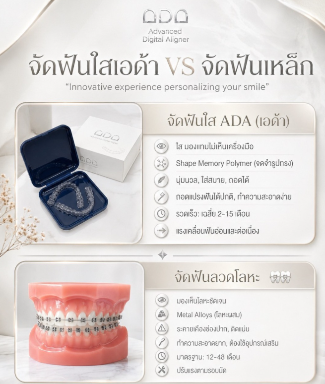 จัดฟันใส Clear Aligner คลินิกทันตกรรมแอพพิคัล